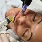 Dermapen