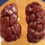 RIÑON