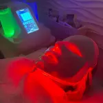Biofotomodulación
