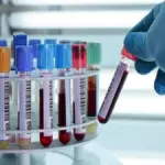 ANTICUERPOS IgG/Igm COVID-19