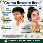 Rescate acné