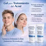 Tratamiento del acné