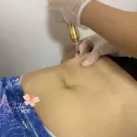 Enzimas sem agulha