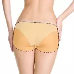 Gluteos (Depilación Laser)