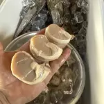 CALLO DE HACHA RIÑON
