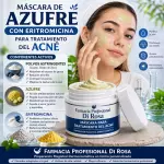 Máscara de Azufre+Eritromic