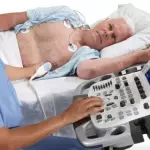 Ecocardiograma
