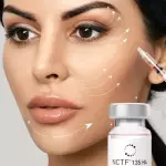 Biorevitalización con NCTF 135 HA