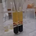 Plasma Rico en Plaquetas