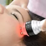 Radiofrecuencia Facial