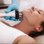 Radiofrecuencia Facial