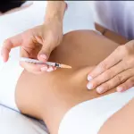 Mesoterapia