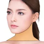 CUELLO (Depilación Laser)