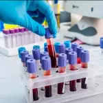 Hematología Completa