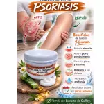 Crema psoriasis